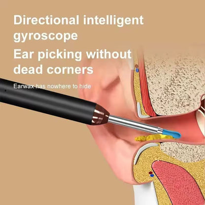 Earwax Cleaner With Camera | LED Flashlight Earwax Cleaner | Earwax cleaner tool kit with 1080P camera WIFI & LED Light | WIFI Camera Ear Cleaner Tool | Smart Visual Ear Cleaner | 360° Visual WIFI Camera Ear Cleaner | Earpick Cleaner With Camera